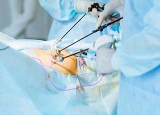 Laparoscopic Surgery and Open Hernia repairs